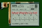 320*240 FSTN LCD Модуль Монохромный для медицинского сканирования положительный