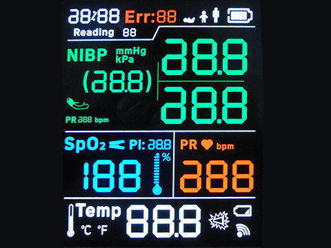 Экран Monochrome 128X64 LCD этапа STN YG ST7565R 7 ставит точки паять FPC